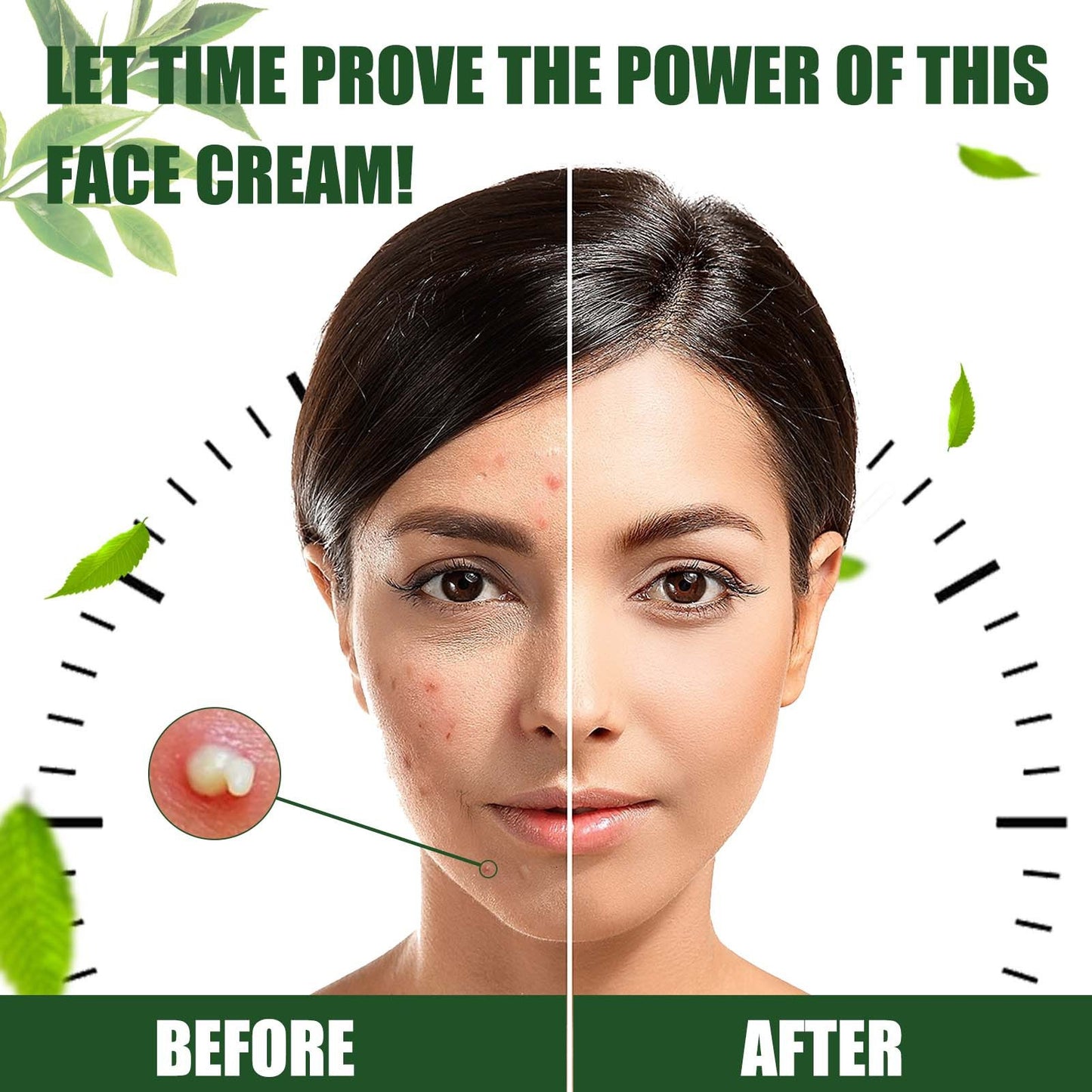 Cream Skin Repair Clean Acne Care